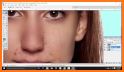 Photo Retouch Blemish Remover related image