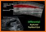 MSK ultrasound Lower Limb related image