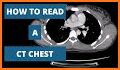 CT Passport Chest / sectional anatomy / MRI related image