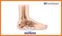 Heel Pain: Causes, Diagnosis, and Treatment related image