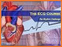 12-Lead ECG Challenge related image