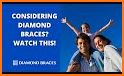 Diamond Braces related image