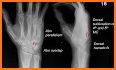 Pocket Tutor: Musculoskeletal Imaging related image