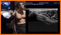 MSK ultrasound Upper Limb related image