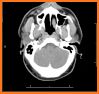 CT Passport Head/Brain / sectional anatomy / MRI related image