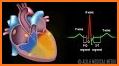 A to Z ECG Interpretation related image