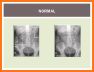 Easy Abdominal X-Ray related image