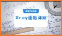 XRAY VPN  - VLESS VMESS Trojan related image