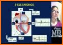 Tutor del ECG Ritmo related image