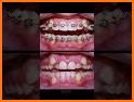 Dentist & Braces doctor - Mouth care surgery related image