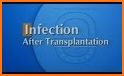 Liver Transplant Education related image