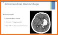 The NeuroICU Board Review related image