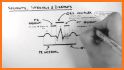 ECG Clinical Interpretation related image