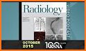 Pulmonary Nodules - Fleishner 2017 Calculator related image