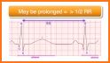 Electrocardiogram (ECG) Rhythm App: Corrected QT related image