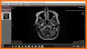 Dicom File Viewer related image