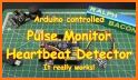 Pulse Monitor related image