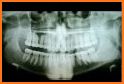 Dental Panoramic Radiology related image