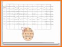 EEG Tutorial related image