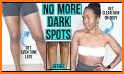 How To Get Rid Of Dark Spots related image