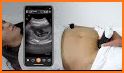 ScanBaby learn baby ultrasound related image