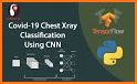 Chest X-Ray Classifier related image
