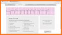 ECG FlashCards - Free related image