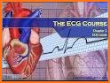 12-Lead ECG Challenge related image