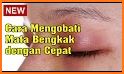 tips sehat dan mudah menyiasati maag saat hamil related image