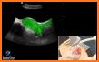 SonoAccess: Ultrasound Education App related image