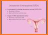 Oral Contraceptives related image