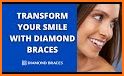 Diamond Braces related image