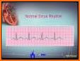 ECG Basics - Full related image