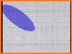 ECG Clinical Interpretation related image