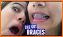 Braces Camera related image