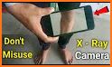 Xray Body Scanner Camera App related image