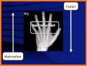 Bone Age related image