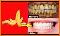 Teeth Cleaning Tips related image