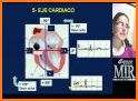 Electrocardiograma ECG Tipos related image