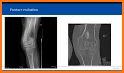 musculoskeletal x-ray interpretation related image