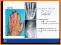 Rheumatology Board Review related image