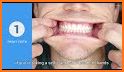 Braces teeth Photo Editor & Selfie Camera related image