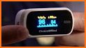 A-oximeter related image