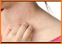 Home Remedies For Skin Allergy related image