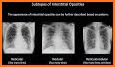 X-ray Interpretation for Medical Use related image