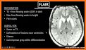 Magnetic Resonance Imaging Sequences related image