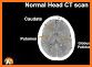 CT Passport Head/Brain / sectional anatomy / MRI related image