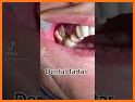 Teeth Cleaner related image