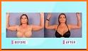 Incredible liposuction related image