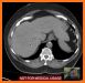 Pocket Atlas of CT ABDOMEN related image